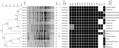 Polymyxin Resistance Among XDR ST1 Carbapenem-Resistant Acinetobacter baumannii Clone Expanding in a Teaching Hospital